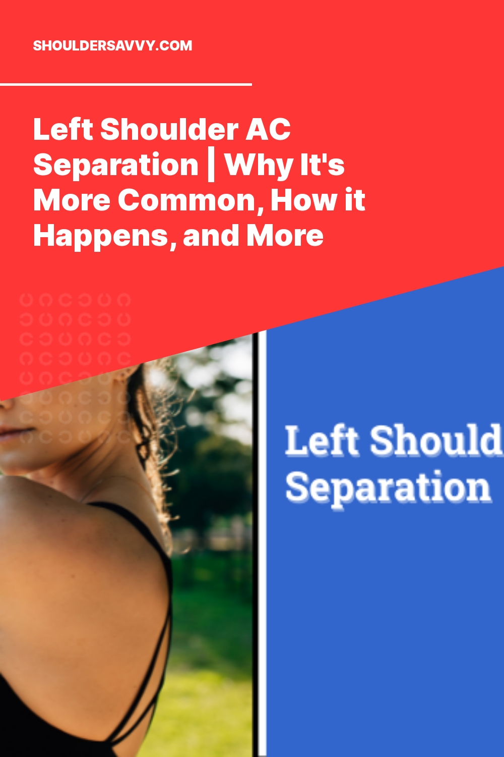 Left Shoulder AC Separation | Why It’s More Common, How it Happens, and More